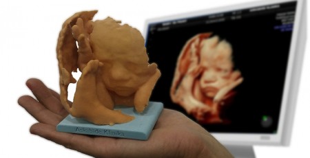 Baby3DPrint